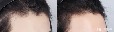 Before & After