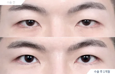 Before & After