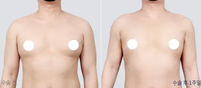 Before & After