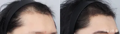 Before & After