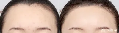 Before & After