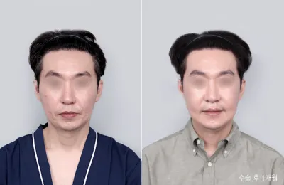 Before & After