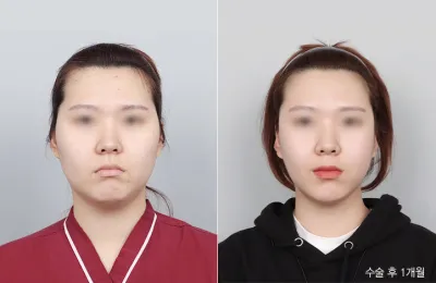 Before & After