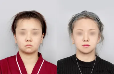 Before & After