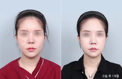 Before & After