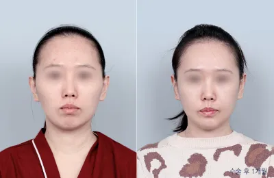 Before & After