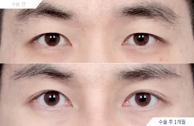 Before & After