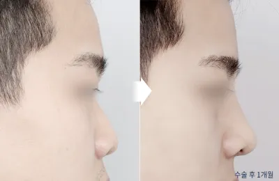 Before & After
