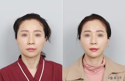 Before & After