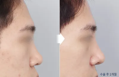 Before & After