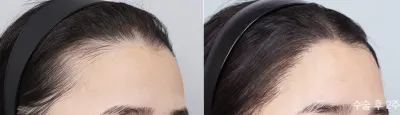 Before & After