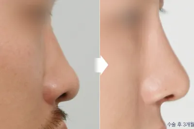 Before & After