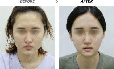Before & After