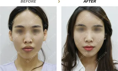 Before & After
