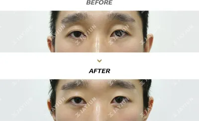 Before & After