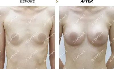 Before & After