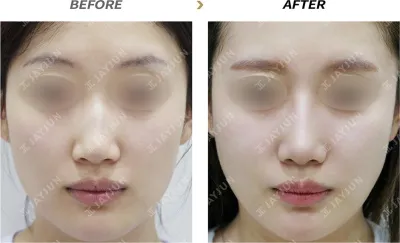 Before & After