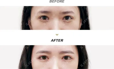 Before & After