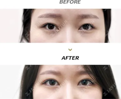 Before & After