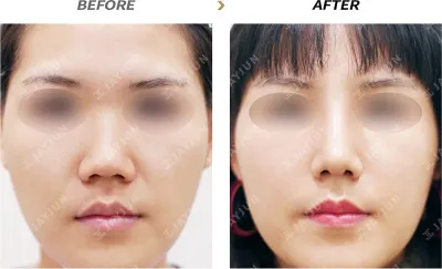 Before & After