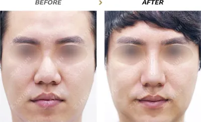 Before & After