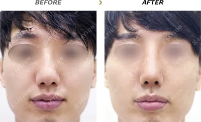 Before & After