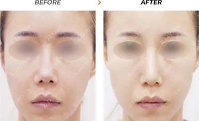 Before & After