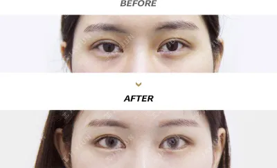 Before & After
