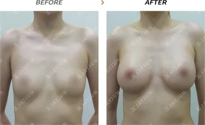Before & After