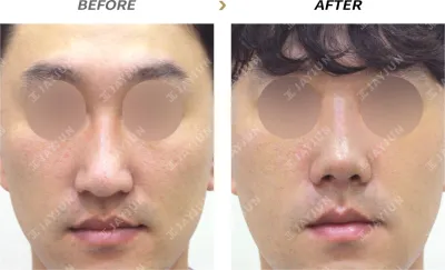 Before & After