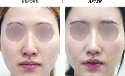 Before & After