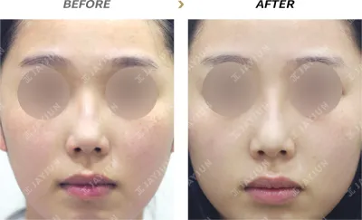 Before & After