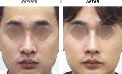 Before & After
