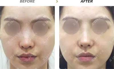 Before & After