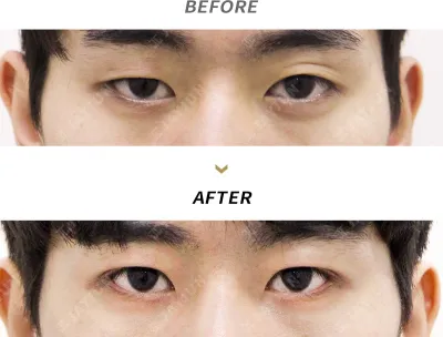 Before & After