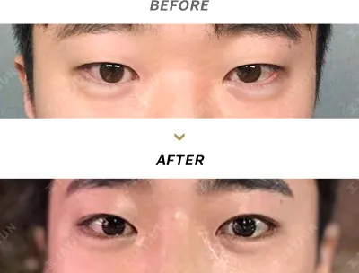 Before & After