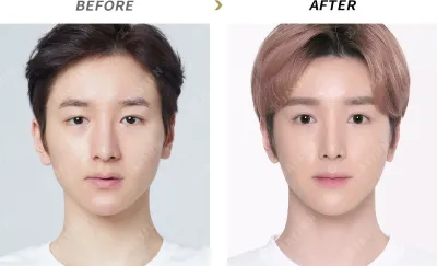 Before & After