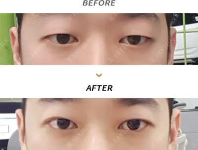 Before & After
