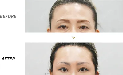 Before & After