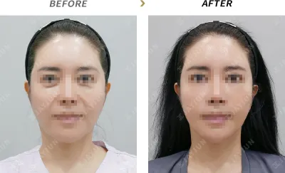 Before & After