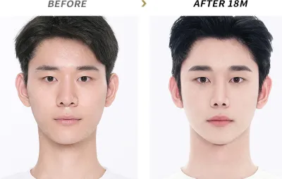 Before & After