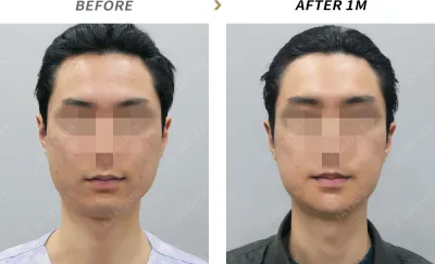 Before & After