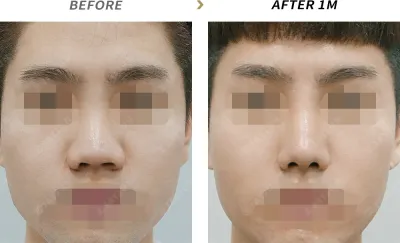 Before & After