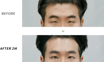 Before & After