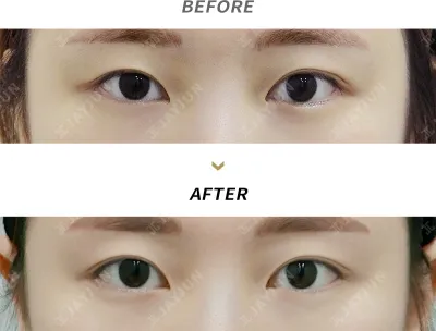 Before & After