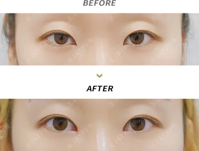 Before & After