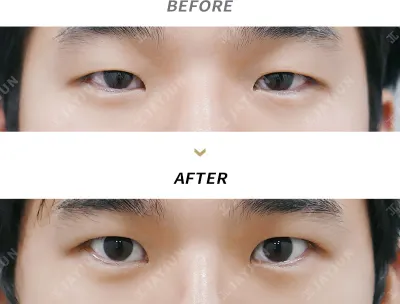 Before & After