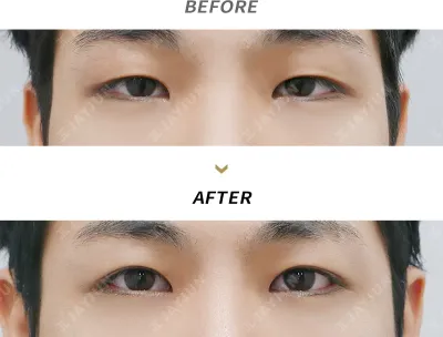 Before & After