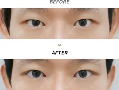 Before & After