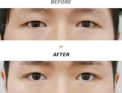 Before & After